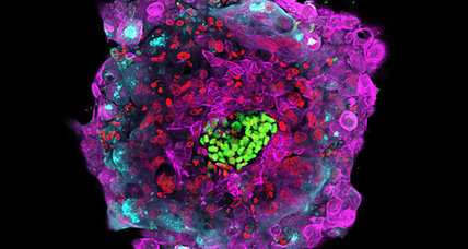 Researchers grow human embryos outside of womb for 13 days. Ethical?